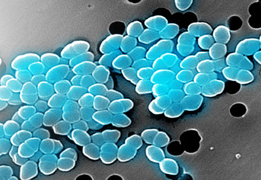 Antibiotic resistant bacteria